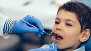 دلایل زرد شدن دندان های کودک