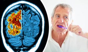ارتباط آلزایمر بین سلامت دهان و مغز