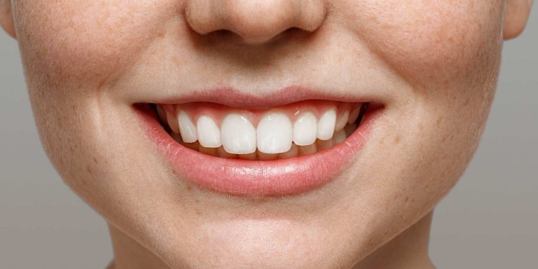 چگونه مینای دندان را تقویت کنیم